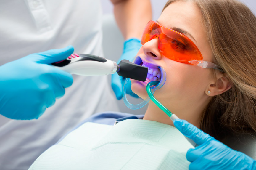 El blanqueamiento es uno de los tratamientos de estética dental más demandados
