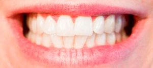 Maloclusión, un problema que se puede tratar a tiempo - Dental Roca