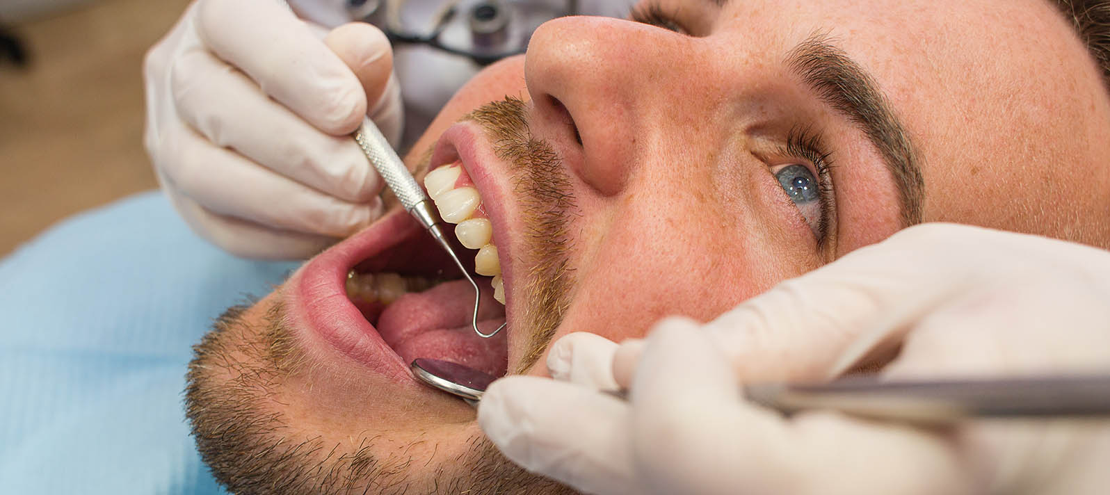 Imagen de revisión dental para ver las causas del dolor de las encías