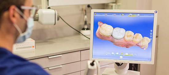 Todo lo que debes saber sobre tus nueva prótesis dental - Dental Roca