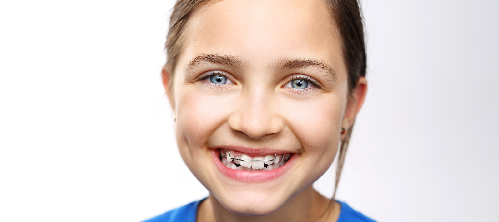 La utilización de ortodoncia interceptiva para acabar con los problemas de mordida imperfecta