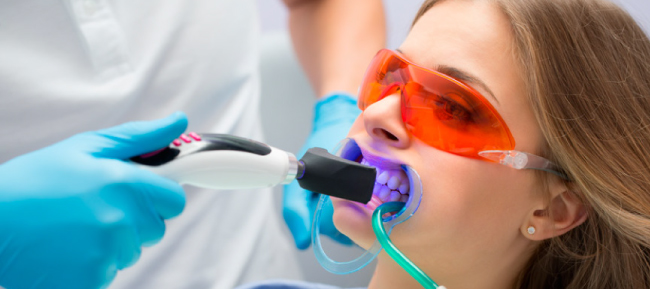 8 cosas que debes saber sobre el blanqueamiento dental