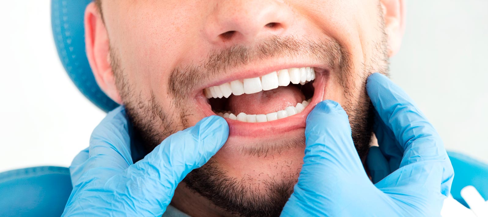 Revisión dental de dientes y encías