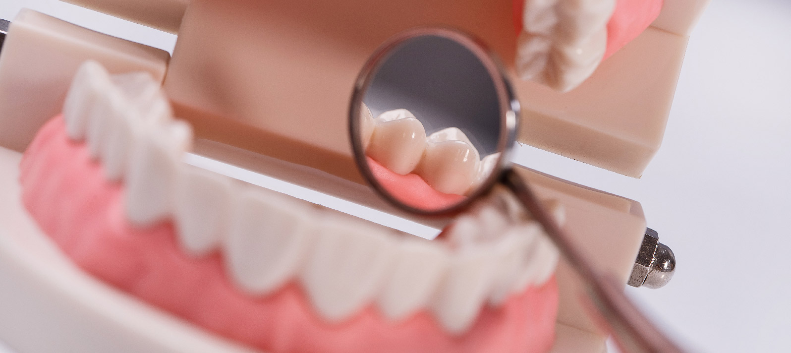 En Dental Roca examinamos tus encías
