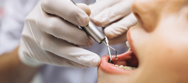 Cómo es una cirugía para un implante dental