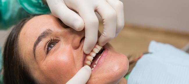 Traumatismo dental: qué hacer después de un golpe en la boca
