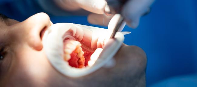 Cirugía oral y maxilofacial en Elche