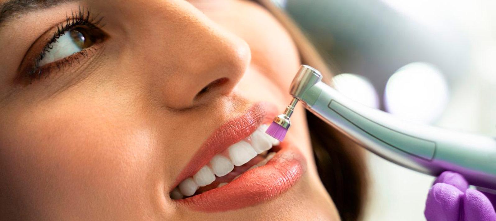 Tratamiento para quitar manchas en los dientes Dental Roca