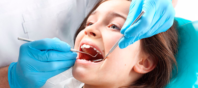 Selladores dentales: qué es y cuando es necesario